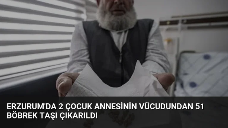 Erzurum’da 2 Çocuk Annesinin Vücudundan 51 Böbrek Taşı Çıkarıldı