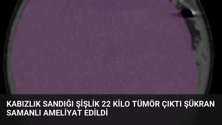 Kabızlık Sandığı Şişlik 22 Kilo Tümör Çıktı Şükran Samanlı Ameliyat Edildi